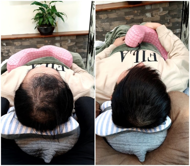  인천정수리가발 대신 남자붙임머리