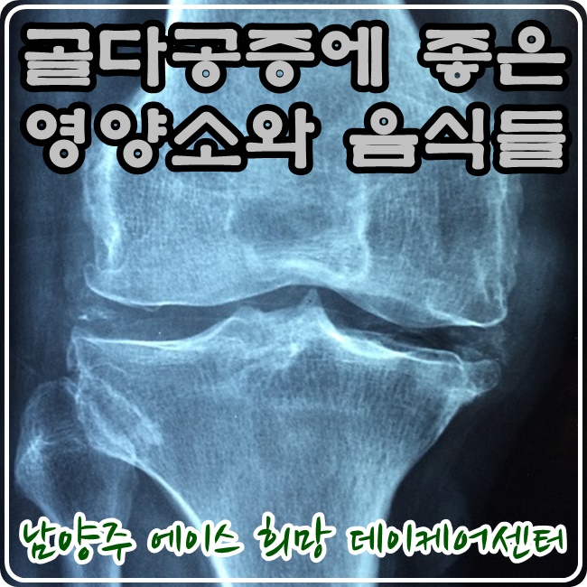  [에이스희망데이케어] 골다공증에 좋은 영양소와 음식들