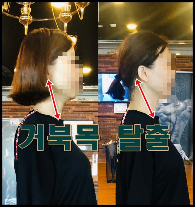  성주동PT 거북목교정 운동 전문가 김도트(정작 본인은 거북목)