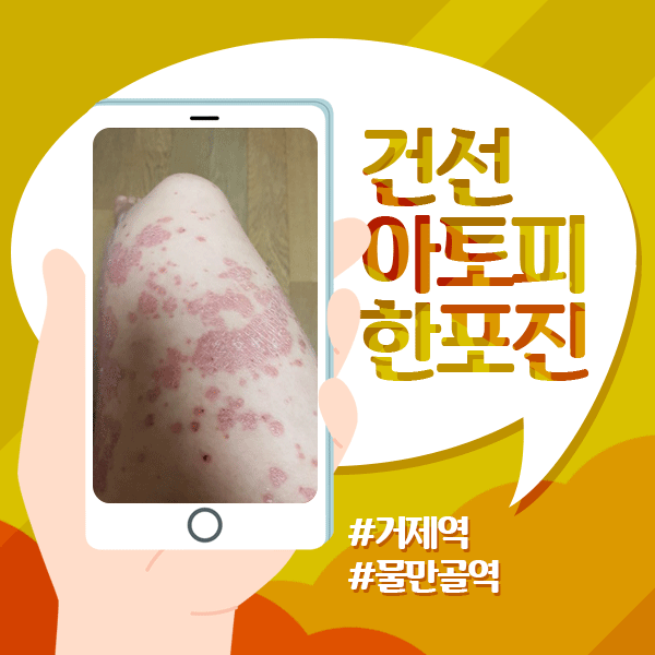  건선은 열을 내려야! 열 내리는 음식과 생활습관