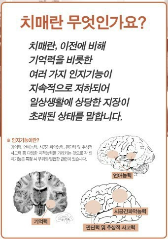  암보다 무서운 병 치매