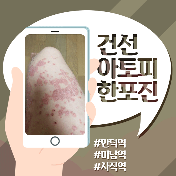  환절기 건선피부 [호호바오일] 얼마나 효과적?