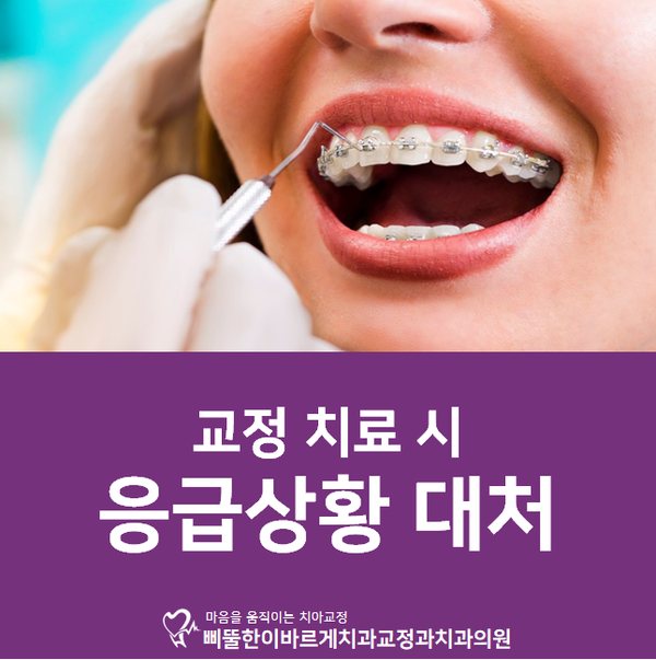[용호동 교정치과] 치아교정 중 응급상황!