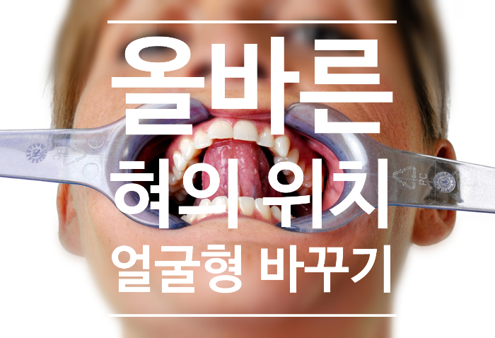 얼굴형 형성에 중요한 올바른 혀의 위치! 얼굴형 형성에 중요한 올바른 혀의 위치!