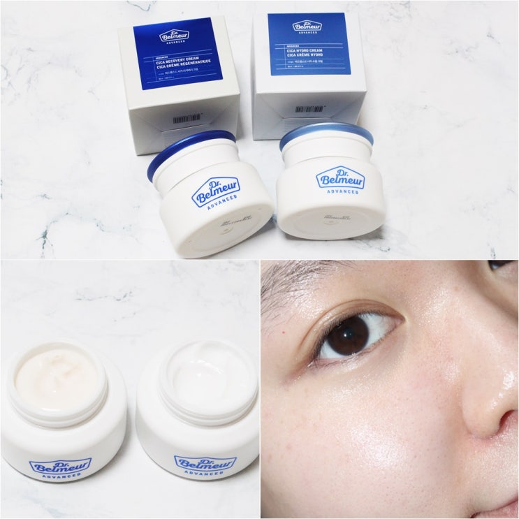  닥터벨머 어드밴스드 시카 리커버리 크림&시카 수분 크림으로 피부 장벽 탄탄하게!