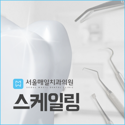  서정리 치과) 정기적인 스케일링으로 구강관리하세요