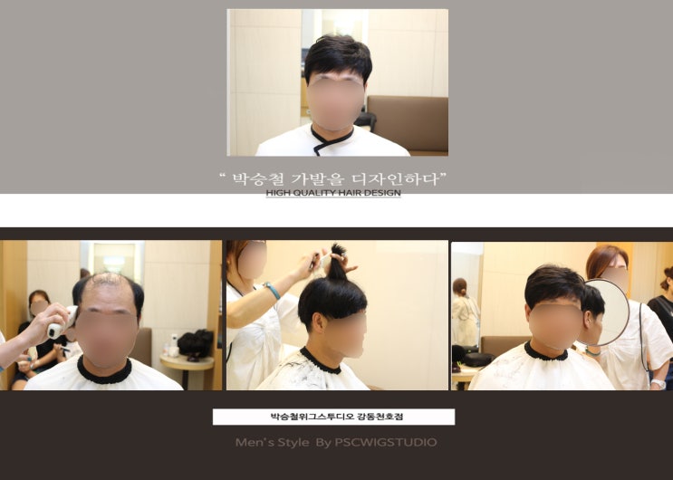  잠실가발, 속없는머리!! 풍성한 정수리남자부분가발