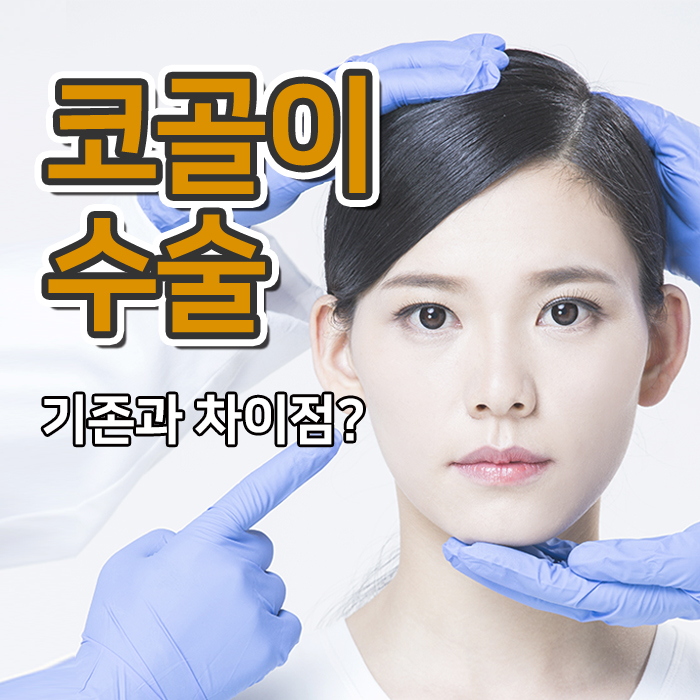  코골이수술, 기존과 달라진 점은?