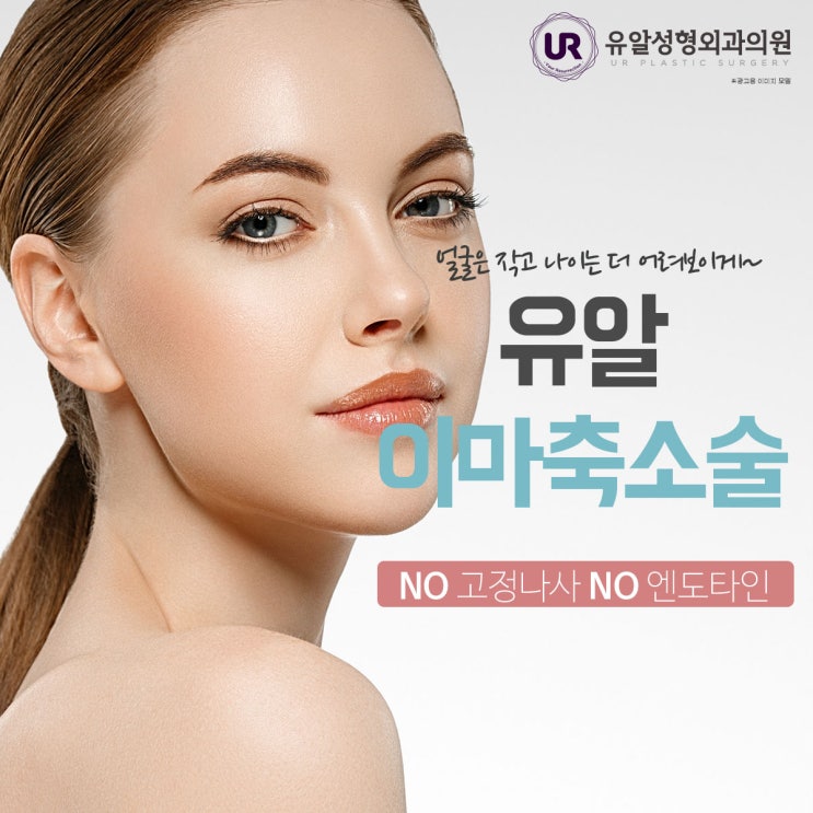  넓은이마성형 휠씬 어려진비결