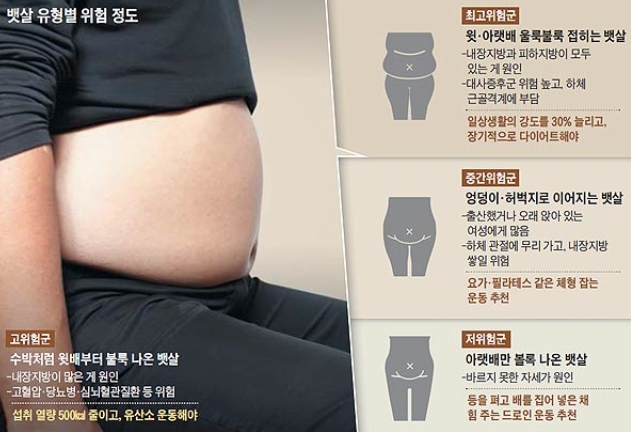 뱃살유형에 따른 건강 위험도