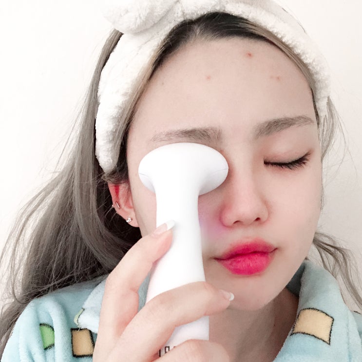 팅팅붓는 눈붓기에는 비비아이로 해결하기