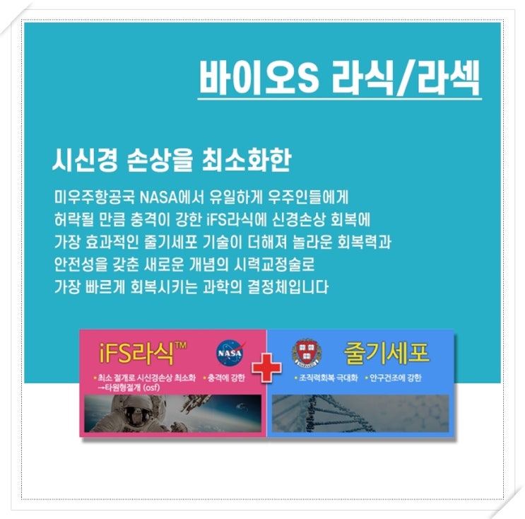  라섹회복기간 유형에 따라 다른 결과