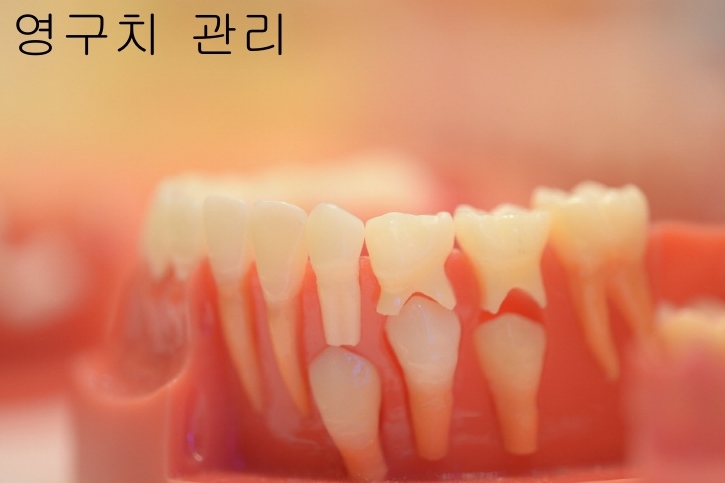  영구치 관리 방법 5가지.(유치관리/충치관리/양치질습관/잇몸과턱뼈/부정교합)