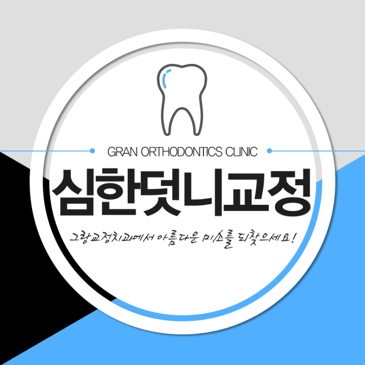  심한덧니교정 긍정적인 결과 보려면
