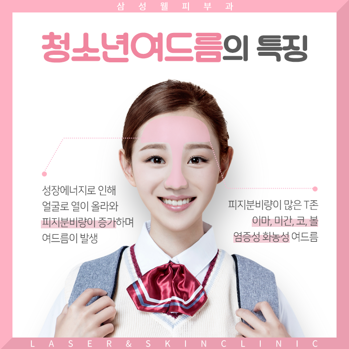  부천여드름 청소년여드름 치료방법은?