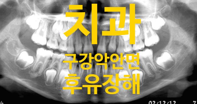  광주광역시 치과병원 손해사정 악안면골절, 치아결손 장해!