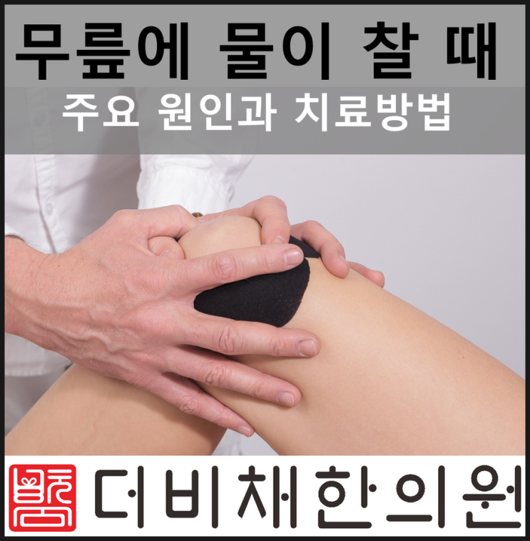  무릎 물 찰때증상, 물이 찼을 때 청주시내에서 봉침 치료로