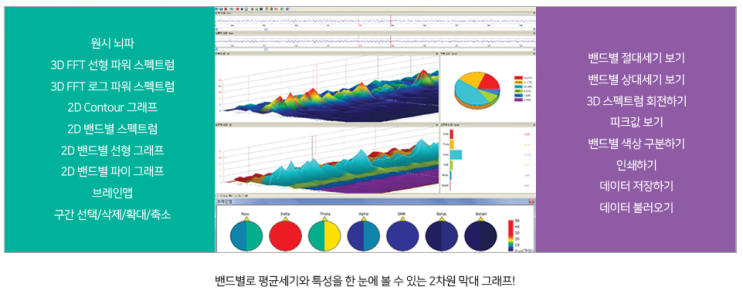  뉴로하모니 질환도 찿아낸다?