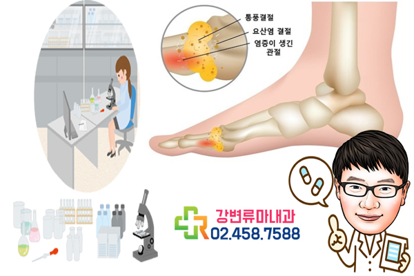  엄지발가락 관절염 통증, 정확한 원인 파악이 중요!!