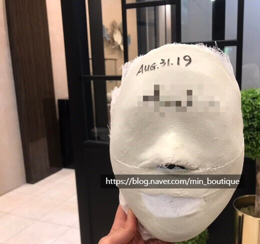  인도네시아 자카르타 약손명가 균형얼굴 6회차 후기 (본점 : 월터르 몽인시디점)