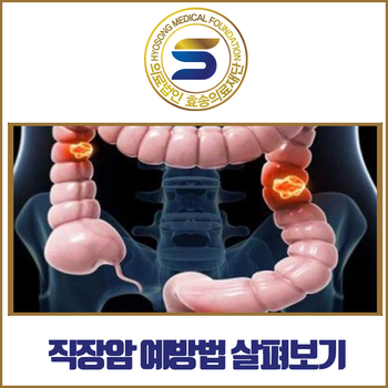  직장암재활병원과 함께 알아보는 직장암 예방법