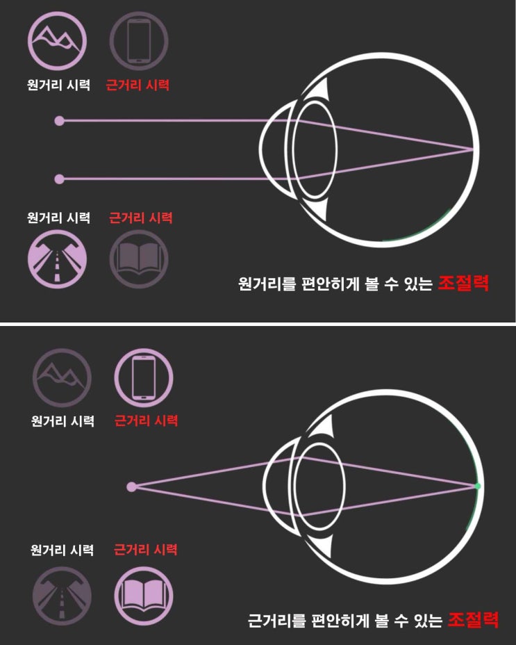  책을 더 편안하게 보기 위한 방법 1탄 / 조절력 부족을 위한 눈 피로 감소용 안경