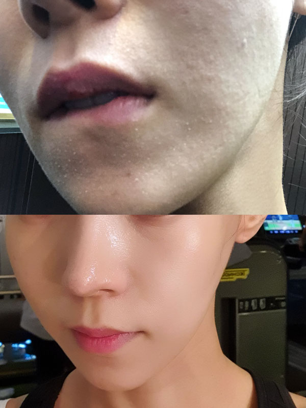피부 뒤집어졌을때 10일만에 피부반전시키기 꿀팁 with.촉촉수도원크림+진정세럼 피부 뒤집어졌을때 10일만에 피부반전시키기 꿀팁 with.촉촉수도원크림+진정세럼