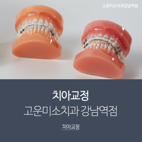  임플란트를 동반한 치아교정