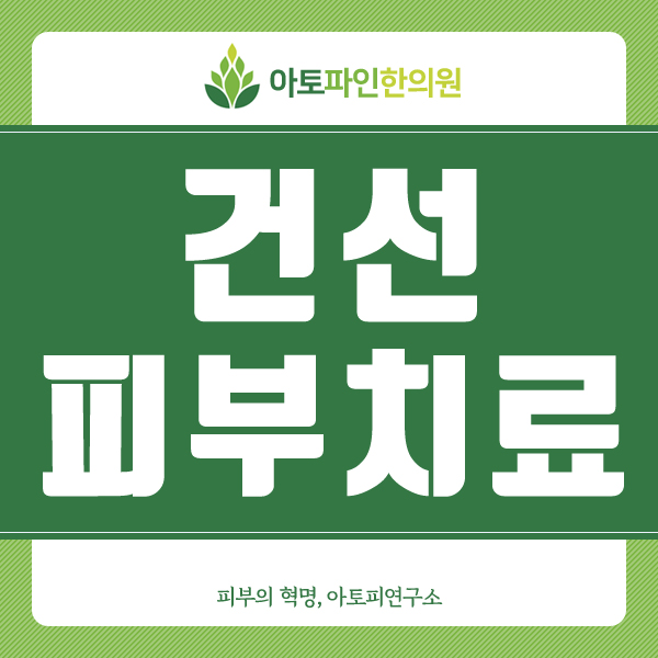  건선피부치료 지속적인 치료가 필요합니다!