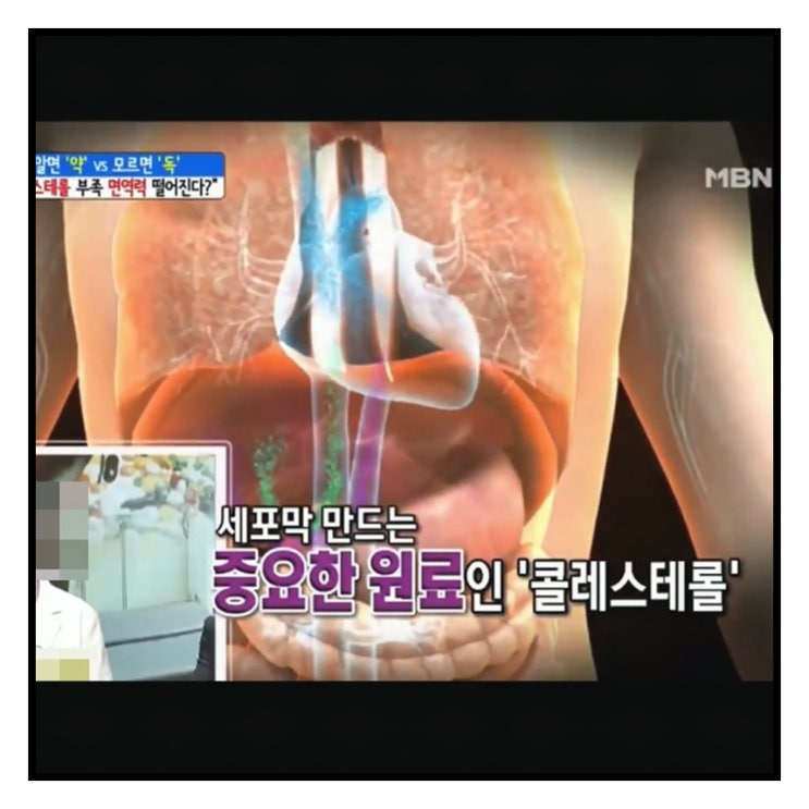  말초혈행장애 어떤 증상이 나타날까