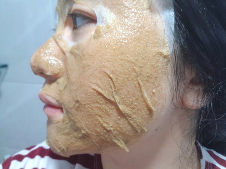  기미잡티제거 최적템 으로 빠르게 해결