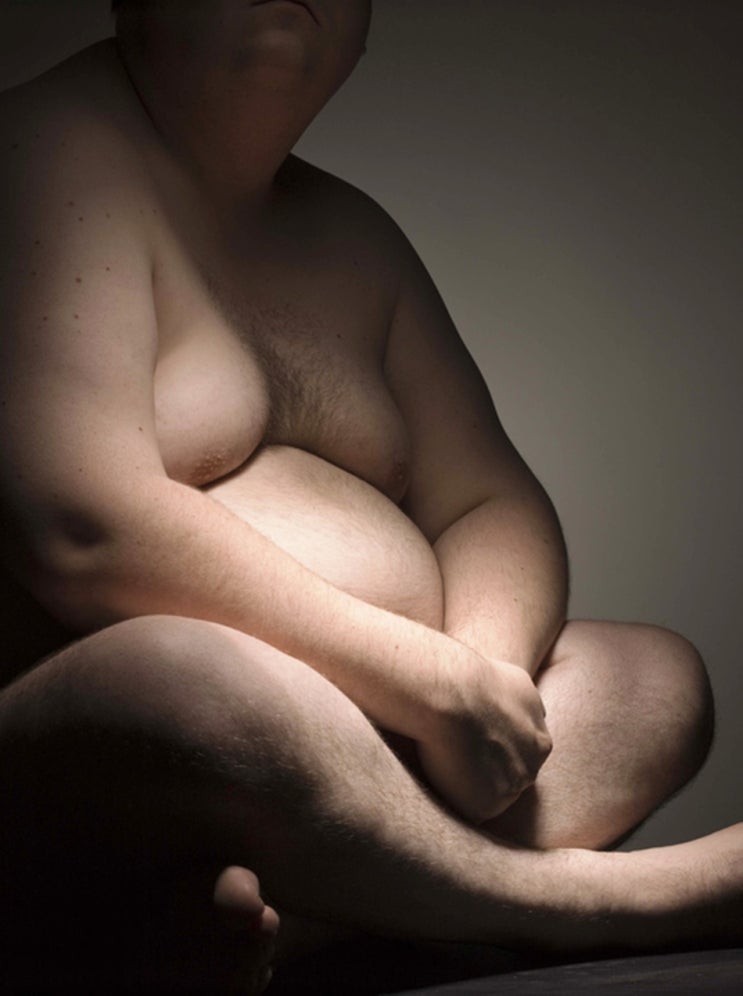  폐쇄성수면무호흡증원인 비만이 미치는 영향