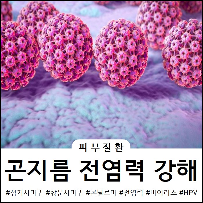  아산곤지름 전염력이 강해 조심해야돼요!