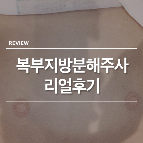  강남역 복부 지방분해주사 가격 골드 아큐주사 한달 후기