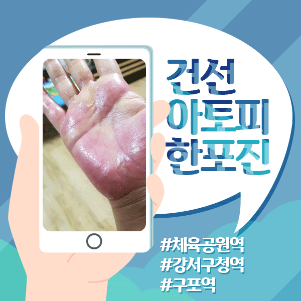  귀 뚫고 난 후 소독해도 염증발생! 켈로이드일까요?