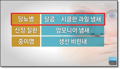  소변 냄새 심하면 혈당관리 필수?![당료 편]
