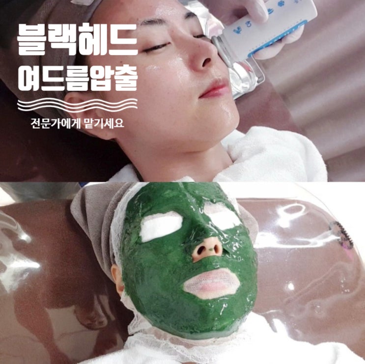  율량동피부관리 청주블랙해드 여드름압출 장인 미라클관리실