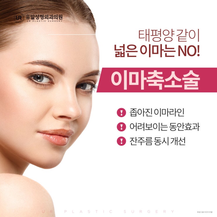  이마축소비용 걱정되지 않아요