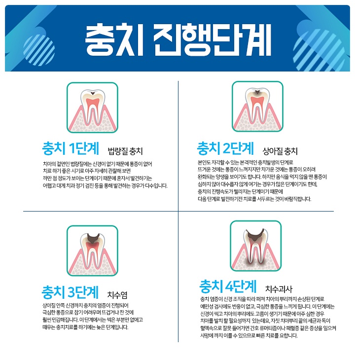 어린이 충치 예방 치료[이거] 치료하면 안심이에요. 7