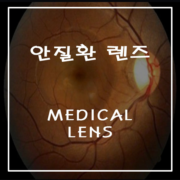  안질환렌즈 ; 황반변성, 녹내장, 백내장 등의 안질환용 렌즈입니다.