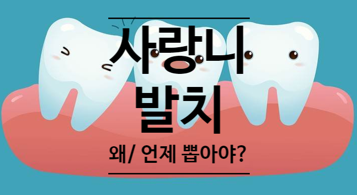 사랑니 왜 있는건가요? 왜 아픈가요? 사랑니 뽑아야하나요?