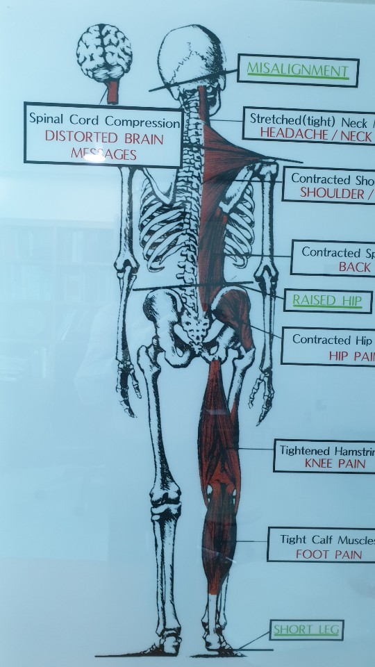 Why do you correct the turtle neck in your back pain?(Haeundae Marine city oriental medical clinic)