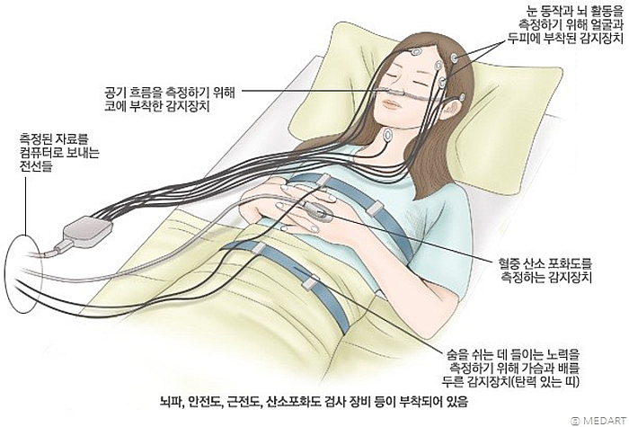  수면 무호흡증(코골이)은 만병의 근원?_두번째 이야기(신불당리건치과)
