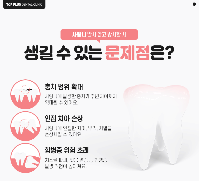 사랑니 목통증, 감기와 헷갈리지 말고 치과로 방문하세요!