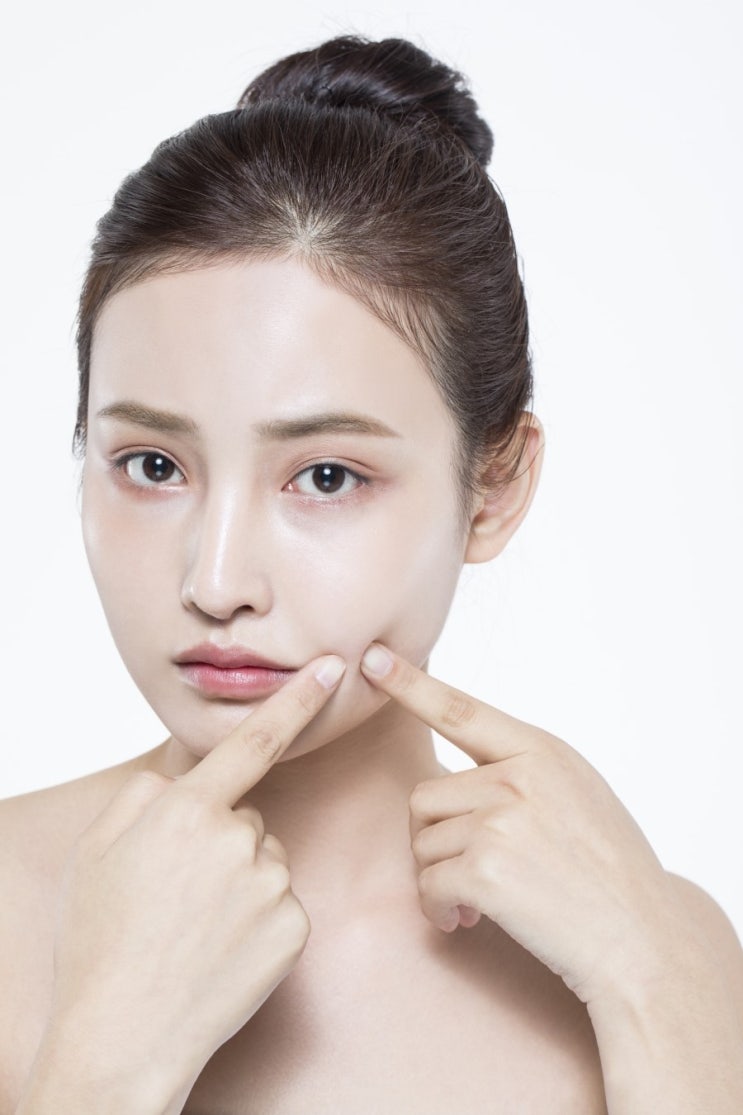대구포항울산구미성인만성여드름원인 피부과치료로효과없을때 근본체질치료 청담미한의원 대구포항울산구미성인만성여드름원인 피부과치료로효과없을때 근본체질치료 청담미한의원