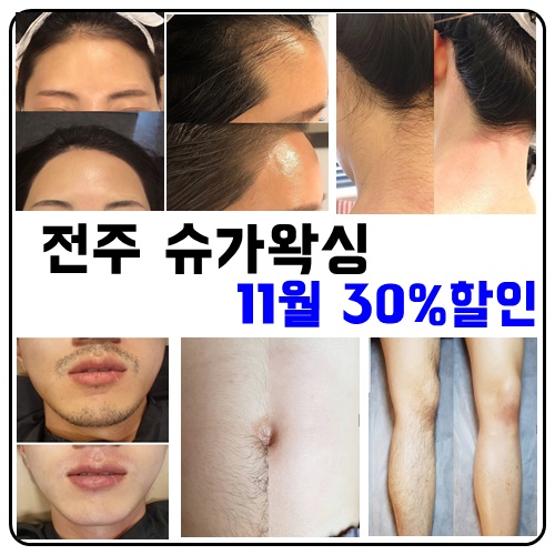  익산 전주왁싱 슈가왁싱으로 안전하게