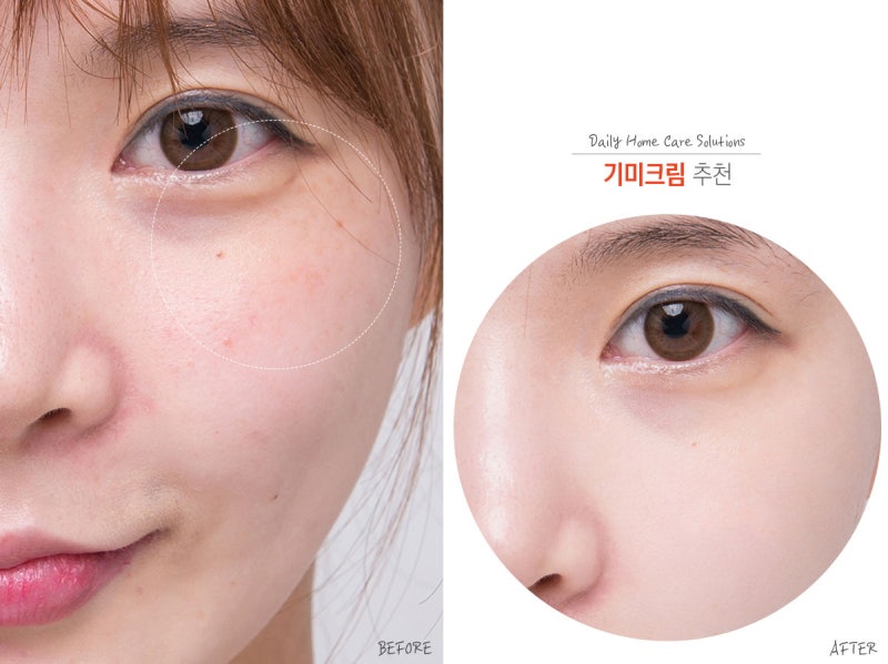 올리브영 기미크림 초반에 잡으며 좋아지기 : 네이버 블로그 올리브영 기미크림 초반에 잡으며 좋아지기 : 네이버 블로그