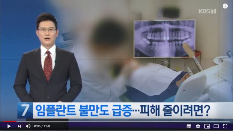 치아 임플란트 불만 급증…“병원 바꾸면 추가 부담” / KBS뉴스 치아 임플란트 불만 급증…“병원 바꾸면 추가 부담” / KBS뉴스