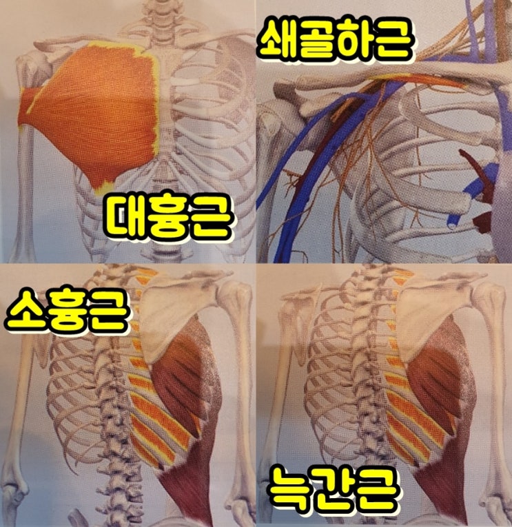 쇄골하근, 대흉근, 소흉근, 늑간근 등 흉부근육 통증치료