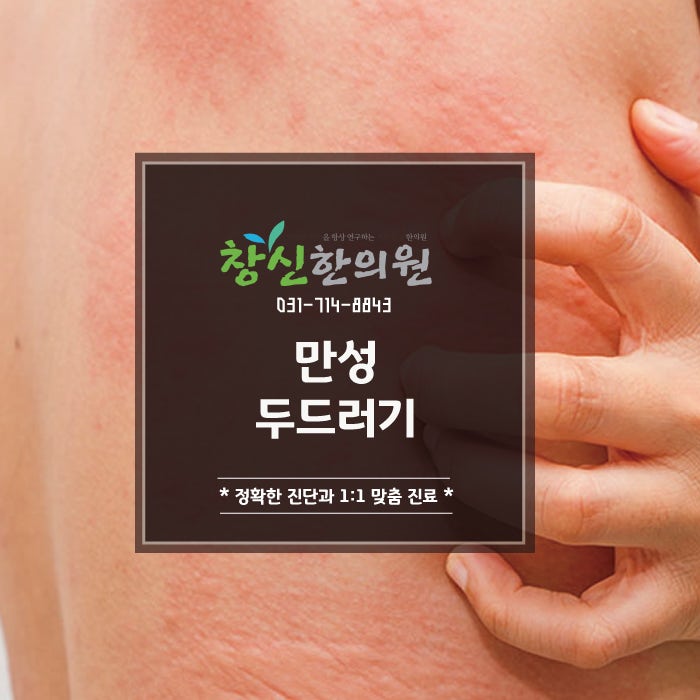 유아 두드러기의 원인과 효과적인 한방치료